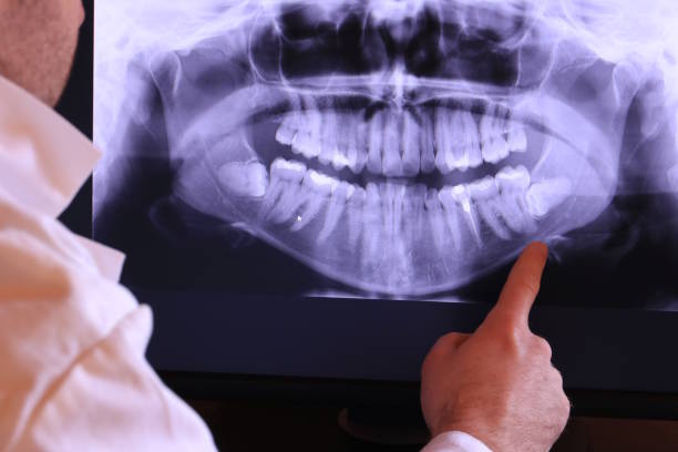 Best Holiday Emergency Dentist in Ogdensburg, NY