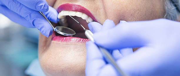 Best Emergency Dental Care for Abscessed Tooth in Ogdensburg, NY